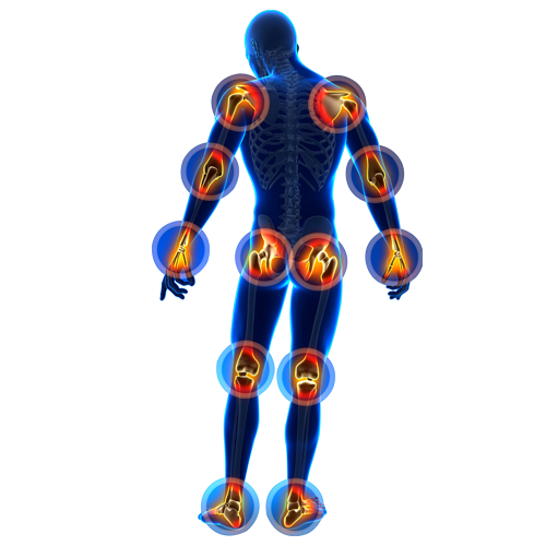 氨糖缺失引發關節問題 御正君骨活丸 及時補充修復