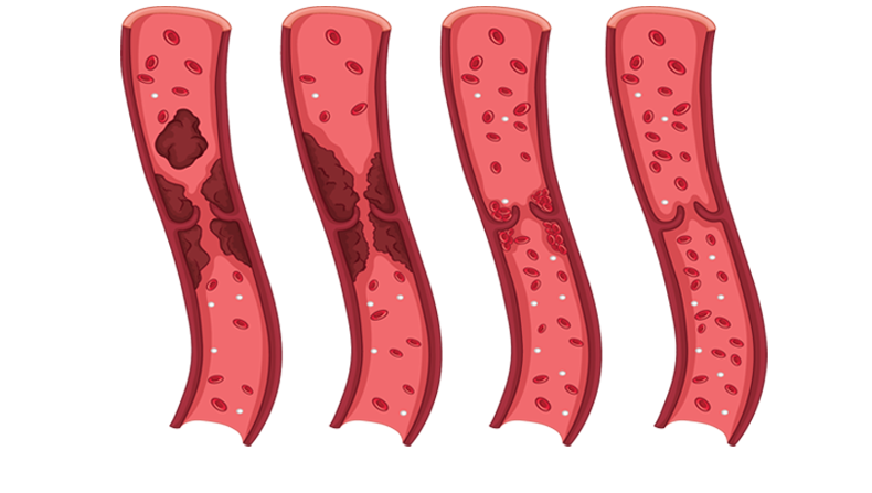 御正君納豆地龍活心素 180 天血管保養 可見改善效果