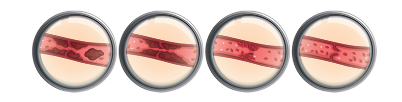 御正君納豆地龍活心素 深層清理血管淤堵 優化血液循環